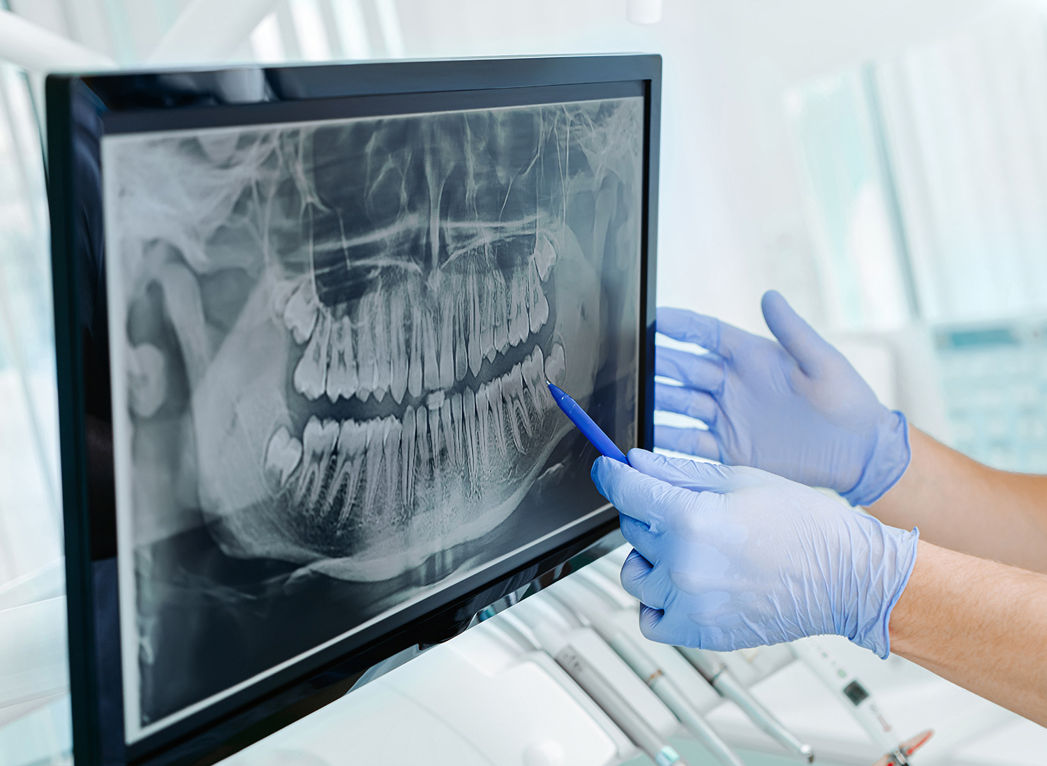 Oral screening test