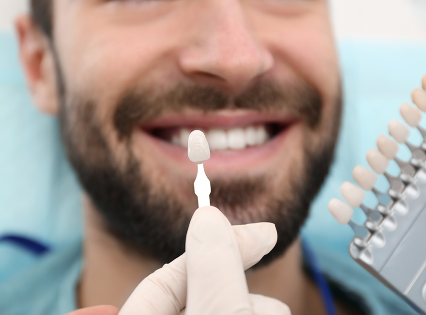 teeth whitening options